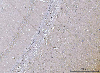 VPS53 Antibody