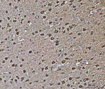 VPS53 Antibody