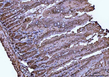 VCP Antibody