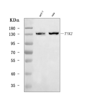 TYK2 Antibody