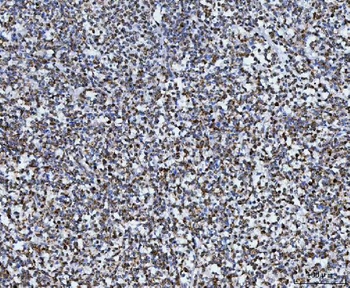 TOMM40 Antibody