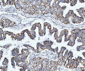 TOMM40 Antibody