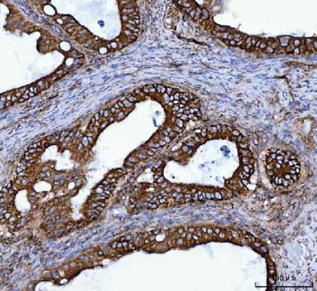 TOMM40 Antibody