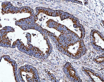 TOMM40 Antibody