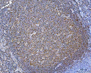 TOMM40 Antibody