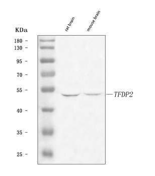 DP2/TFDP2 Rabbit Polyclonal Antibody