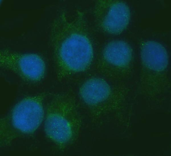 RGS7 Rabbit Polyclonal Antibody
