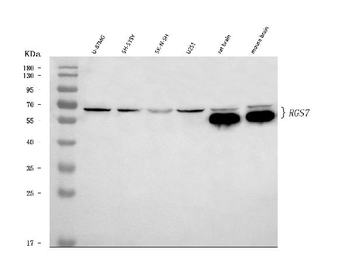 RGS7 Rabbit Polyclonal Antibody