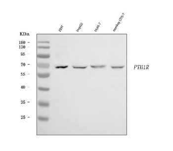 Parathyroid Hormone Receptor 1/PTH1R Rabbit Polyclonal Antibody