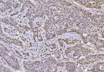 hnRNP U/p120/HNRNPU Antibody