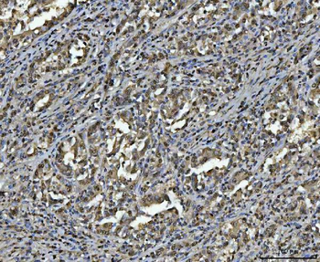 hnRNP U/p120/HNRNPU Antibody