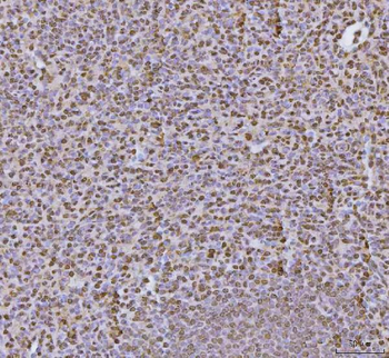 hnRNP U/p120/HNRNPU Antibody