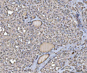 hnRNP U/p120/HNRNPU Antibody