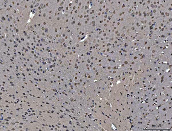 hnRNP U/p120/HNRNPU Antibody