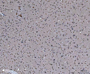 hnRNP U/p120/HNRNPU Antibody