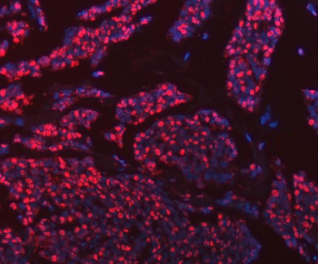 hnRNP U/p120/HNRNPU Antibody