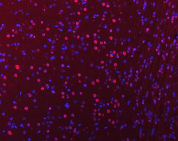 hnRNP U/p120/HNRNPU Antibody