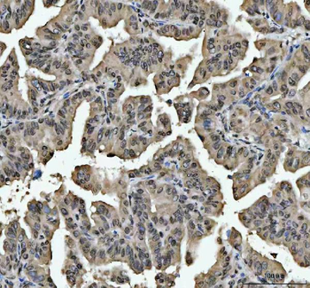 hnRNP L/HNRNPL Antibody