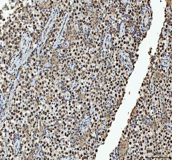 hnRNP L/HNRNPL Antibody
