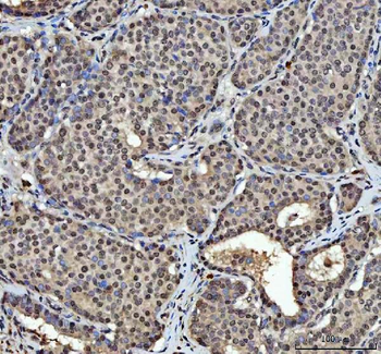 hnRNP L/HNRNPL Antibody