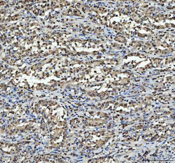 hnRNP L/HNRNPL Antibody