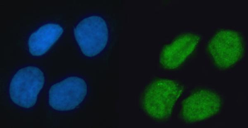 hnRNP K/HNRNPK Antibody