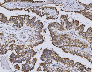 Heme oxygenase 2/HMOX2 Rabbit Polyclonal Antibody