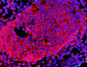 HMGCR Rabbit Polyclonal Antibody