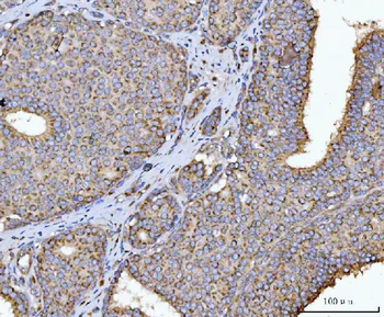 HMGCR Rabbit Polyclonal Antibody