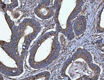 HMGCR Rabbit Polyclonal Antibody