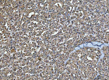 HMGCR Rabbit Polyclonal Antibody