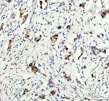 GSK3 beta/GSK3B Antibody
