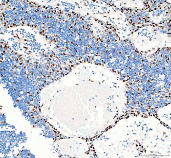GSK3 beta/GSK3B Antibody