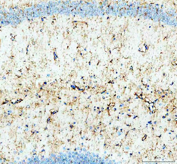 GSK3 beta/GSK3B Antibody