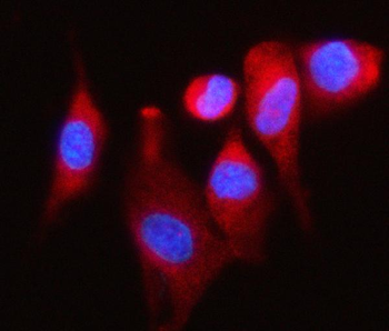 P97/DAP5/EIF4G2 Rabbit Polyclonal Antibody