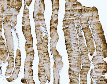 DOCK4 Rabbit Polyclonal Antibody