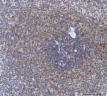CAD Rabbit Polyclonal Antibody