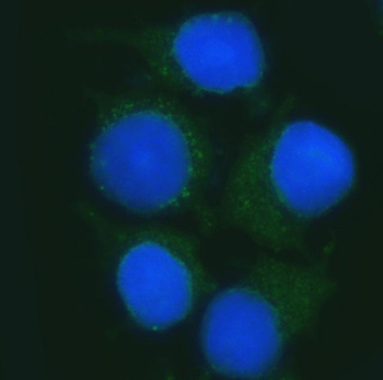 B3GNT2 Rabbit Polyclonal Antibody
