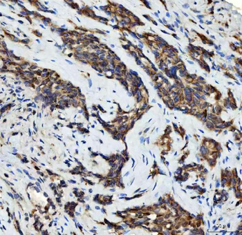Aurora A/AURKA Antibody
