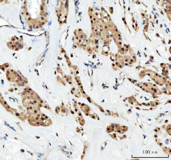 Aurora A/AURKA Antibody
