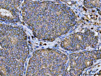 ARL13B Antibody
