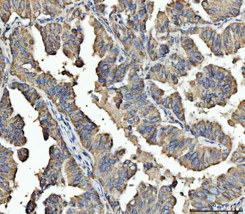 ARL13B Antibody