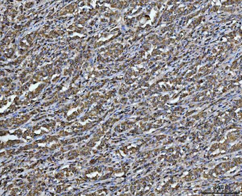ARL13B Antibody