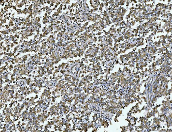ARL13B Antibody
