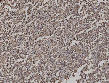 ARL13B Antibody