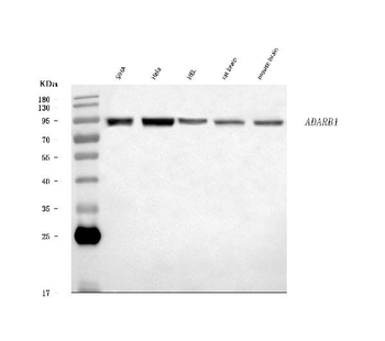 RED1/ADARB1 Rabbit Polyclonal Antibody