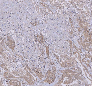 WDR44 Antibody