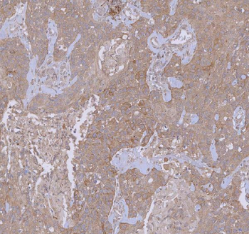 WDR44 Antibody