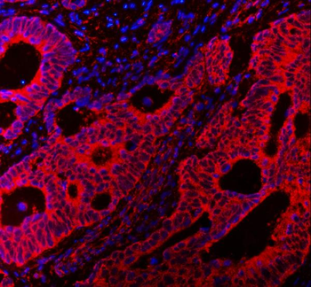 VAPA Antibody