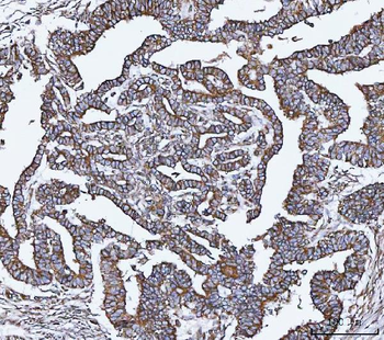 VAPA Antibody